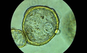 AZO Nano