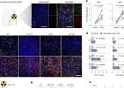 Copper-based nanocapsules shown to enhance radiotherapy effectiveness
