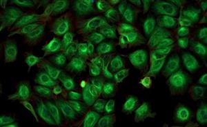 Destabilized Near-Infrared Nanobodies for Enhanced GFP Imaging