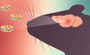 Nanodiscs Target Cholesterol to Fight Aggressive Brain Tumor