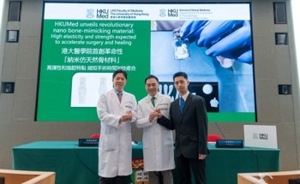 AZO Nano