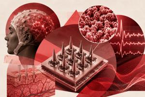 Nanostructured Platinum Boosts Dry Microneedle EEG Perf ...